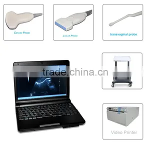 CE Approved Laptop Ultrasound Machine With 3.5Mhz Multi-frequency Convex Probe RUS-9000F thumbnail-1