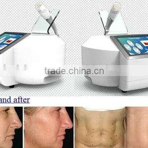 Hot Sale Portable Home-use RF 9D Thermacool Skin Resurfacing and RF Thermacool Effectively Machine thumbnail-5