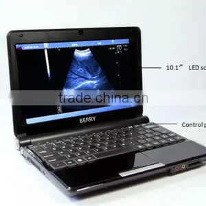 Veterinarian B Mode Ultrosound Scanner Machine 7.5MHz Probe Horse Cattle Sheep thumbnail-1