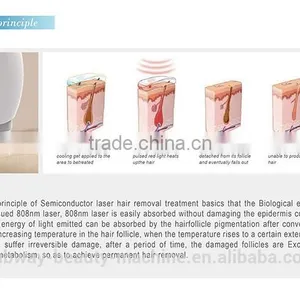 Hot Sale Real Painless 808nm Diode Laser Permanent Epilator thumbnail-2
