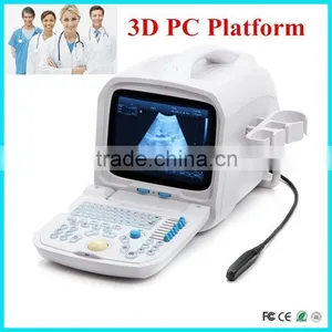RUS-9000A PC Based Portable Ultrasound /Cheap Ultrasound Scanner/Machine 3.5Mhz Multi-frequency Convex Probe-Shelly thumbnail-1