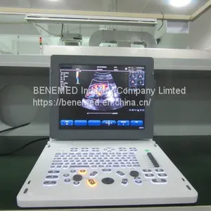 Echo Color Doppler Ultrasound Scanner Bene-5 thumbnail-1