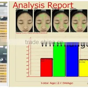 Auto Facial Skin Portable Analyzer With Customer Datebase and 10 Mega Pixels Camera thumbnail-4