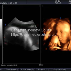 Portable 4D Color Doppler Ultrasound Scanner BENE-3V thumbnail-3