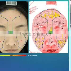 Quantum Analysis Machine/quantum Resonance Magnetic Skin Analyzer Machine thumbnail-3