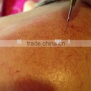 Facial Vascular Removal 30MHz Spider Vein Removal Machine thumbnail-6