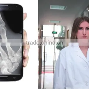 X Ray Digital Radiographic System FPD DR Cheap Flat Panel Detector thumbnail-6