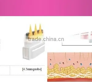 Portable Hifu Wrinkle Removal Hifu For 5.0-25mm Facial Beauty&salon Machine Without Vertical Stand Expression Lines Removal thumbnail-5