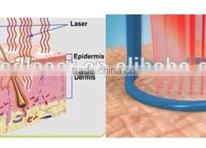 100um-2000um Vaginal Rejuvenation Vaginal Rejuvenation Laser Fractional Skin Resurfacing Co2 Gynecology Therapy Machine Treat Telangiectasis thumbnail-5