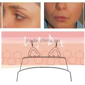 rf Treatments Ultrasound Skin Tightening Care Equipment thumbnail-6
