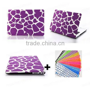 for Apple Macbook Pro 11 Case, Matt Cover Case for Macbook Pro Retina 11 13 15, for Macbook Air 11 13 Case thumbnail-4