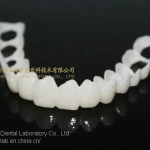 CAD/CAM PMMA Resin Clip on Veneers, Snap-on-veneers, Smile Veneers, Laboratoire Dentaire, Dentallabor, Laboratorio Dental, Dental Laboratory, Shenzhen LJ Dental Lab China thumbnail-3