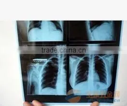 Konida Automatic Fuji Dry Film Laser Medical Hot Sex X-ray Film thumbnail-3