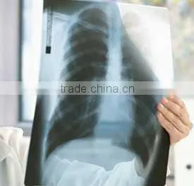 Medical Thermal x Ray Film,film Manufacturer ,dental X-ray Film thumbnail-1