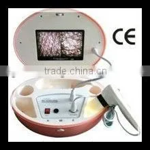 Portable Skin Analyzer & Scope Analyzer thumbnail-1