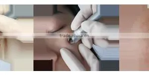 Portable 980nm Diode Laser Vascular&red Vein Removal Beauty Equipment thumbnail-4
