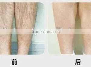 Professional Portabel Big Spot Size Epilation IPL Laser Hair Removal Machine for Beauty Salon Spa Clinic thumbnail-6