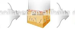 Fractional RF Microneedle for Face Lift Skin Rejuvenation Treatment thumbnail-5