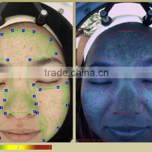 LD6021C Magic Mirror Skin Analyzer Products Recommed thumbnail-4