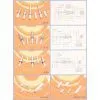 South Korea Zirconia Ferrules thumbnail-1