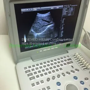 Portable B/W Ultrasound Scanner With Clear Image Quality Hospital Equipment thumbnail-3