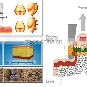 Body Fat Analysis Vacuum Treatment Head Slimming Machine thumbnail-3