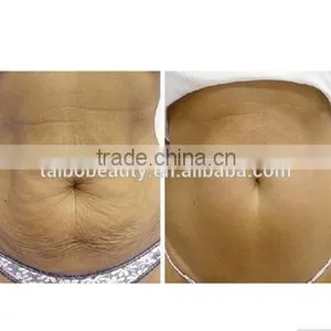 Cryolipolisis Fat Freeze Machine Body Sculptor Slimming Freezer Body Contouring Beauty Salon Equipment Supplier thumbnail-6