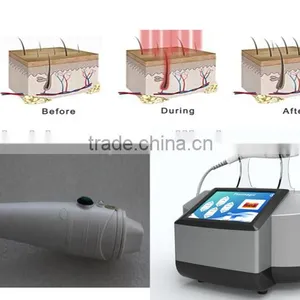 Hot Sale Portable Home-use RF Thermacool Wrinkles Eliminate and Facial Shape BR818 With CE thumbnail-4