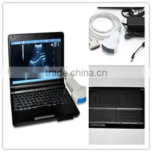 Clear Image Laptop Type Ultrasound Scanner System Full Digital Machine in Transport Carriage thumbnail-1
