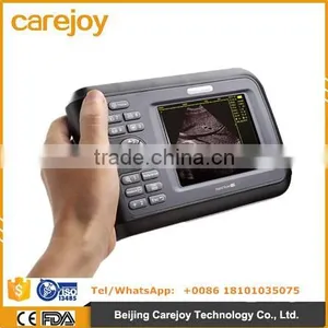 Portable Ultrasound Scanner 2.5MHZ-7.5MHZ for OB GYN Cardio With CE ISO Certification thumbnail-1