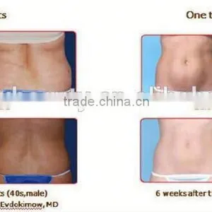 M-C201 2016 Updated Slimming Machine/portable Fat Freezing Machine/fat Freezing Machine for Home Use thumbnail-6