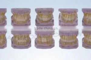 Orthodontic Classification Model ( Two-color , a Set of 10 Groups )/dental Orthodontic Modelsmodels thumbnail-1