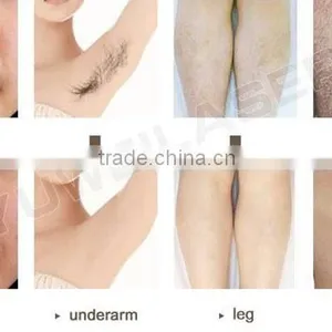 Fine Lines Removal Wholesale Price Multifunctional Medical E-light Ipl And Rf For Hair Removal thumbnail-6