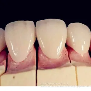 Factory Direct Dental Lab Supply Quality Zirconia Sintering Dental Lab Equipment thumbnail-5