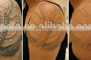 Chinese Apolo ISO CE Approved Beauty Machine Top Tattoo Machine thumbnail-4