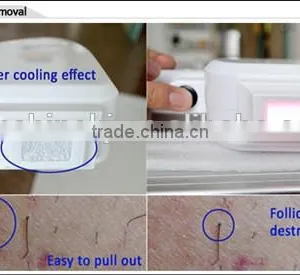 2015 New Multi-function 2 in 1 Alexsandrite Laser Hair Removal With 808 System thumbnail-4