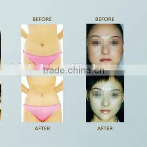 Vertical SL-4 Cryolipolysis Fat Freeze 220 / 110V Body Shaper Slimming Machine Body Contouring thumbnail-4