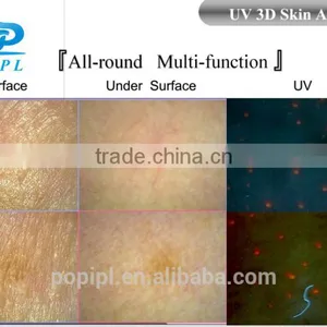 Factory Price UV 3D Facial Skin Analyzer thumbnail-4