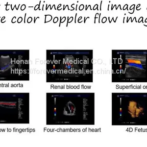 China Trolley 4D Color Doppler Ultrasound (YJ-U10T) thumbnail-5