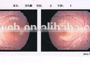 China MCT-A/High-end MCT Technology For Child Amblyopia thumbnail-2