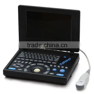 10.4 Inch LCD Laptop Ultrasound Machine PC System 3.5Mhz Convex Probe 7.5MHz Linear Probe Portable Ultrasound Scanner Price thumbnail-3