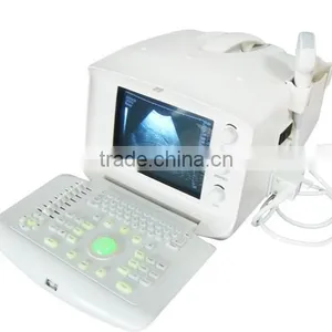 Portable Ultrasound Machine/Scanner 10 Inch With Convex Probe Optional Video Thermal Recorder Sony UP898 RUS-6000A thumbnail-4