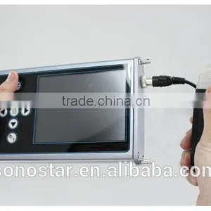V3 Veterinary Palm Ultrasound Sca thumbnail-3