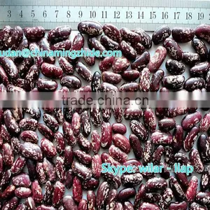 Purple Speckled Kidney Beans New 2014 thumbnail-1