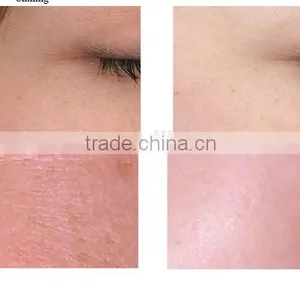 Relieve Skin Fatigue Professional Langdi Professional Best Water Oxygen Skin Oxygen Facial Skin Care Skin Treatment Machine Deeply Clean Jet Peel Machine With Ce Salon thumbnail-6