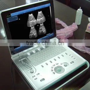 Sonostar Hospital Veterinary Equipment B Model Ultrasound Machine for Sale V9 thumbnail-3