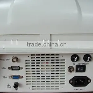 CE Approved Portable B-Mode Ultrasound Scanner With 3.5Mhz Multi-frequency Convex Probe RUS-6000A thumbnail-4