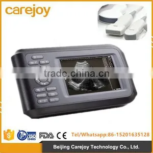 2016 New Handheld Ultrasound Scanner Palm Ultrasound Machine thumbnail-1