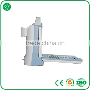 Hospital Equipment Laptop Ultrasound Machine/portable Ultrasound Scanner KX5600 thumbnail-3