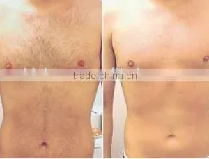 Permanent 808nm Diode Laser Bode Hair Removal With No Pain Arm / Chest Hair Removal thumbnail-4